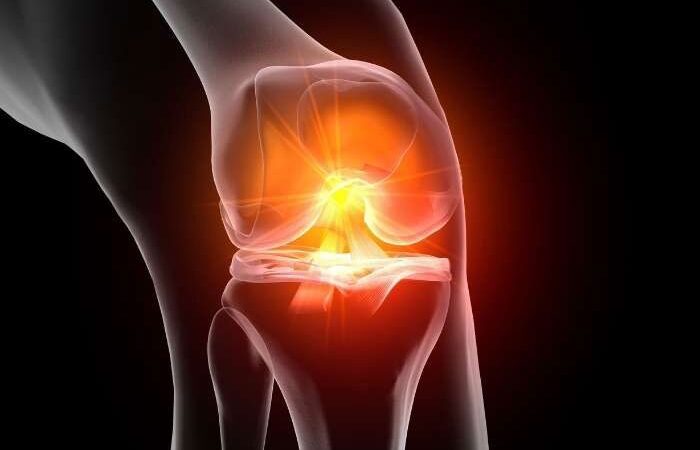 جراحی زانو؛ کی و چرا باید این تصمیم مهم را گرفت؟