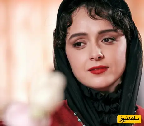 ترانه علیدوستی و بیماری دردناکی که زیبایی‌اش را به تاراج برد: پوست بدنم نابود شد!