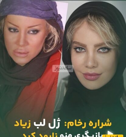 شراره رخام: چگونه تزریق ژل لب، بازیگری‌ام را به خطر انداخت؟ گرایش جدیدم به نچرال بودن را بشنوید!