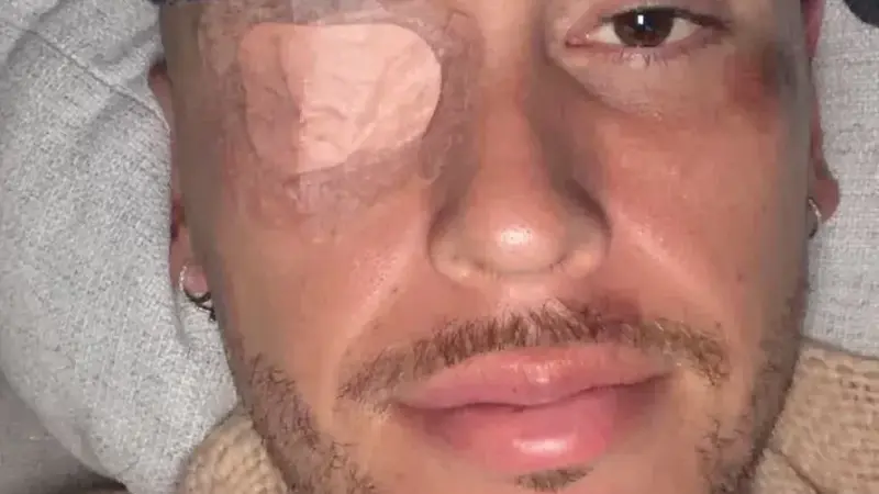 ستاره آرژانتینی از ناحیه صورت فلج شد!