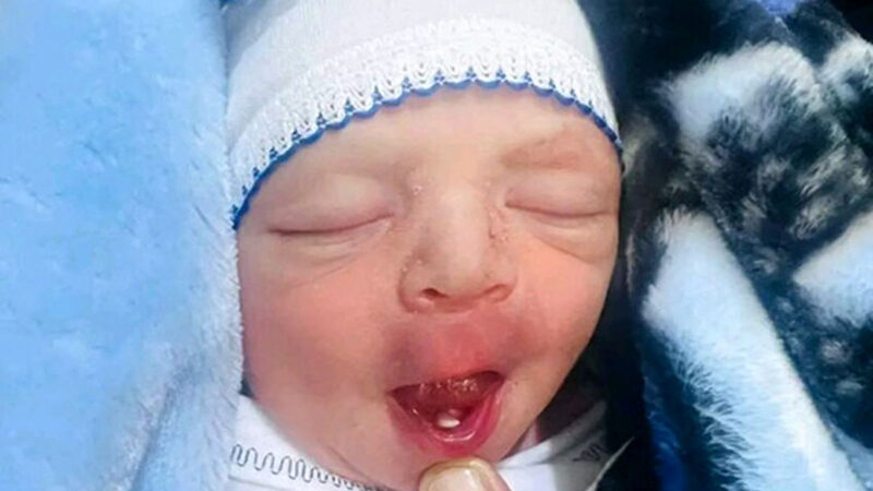 نوزادی در بابل با دندان شیری متولد شد؛ ماجرای شگفت‌انگیز کشیدن دندان در اولین روزهای زندگی!