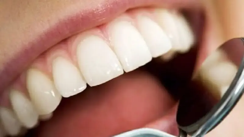 جرم گیری پایه ای ترین درمان دندانپزشکی و بی ضرر است