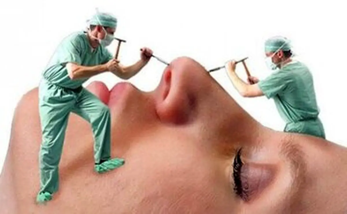 راز تاریک پشت پرده جراحی‌های زیبایی؛ چرا شیادان بازار پررونقی دارند؟