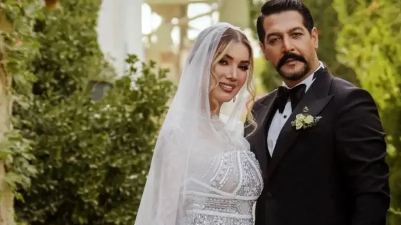 سفر زمان با متین ستوده؛ نگاهی متفاوت به عکس‌های پیش از عمل زیبایی