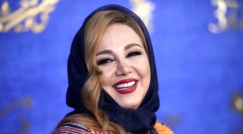 روتوش‌زدایی بهنوش بختیاری و ترلان پروانه در یک قاب؛ کدام چهره طبیعی‌تر و جذاب‌تر است؟