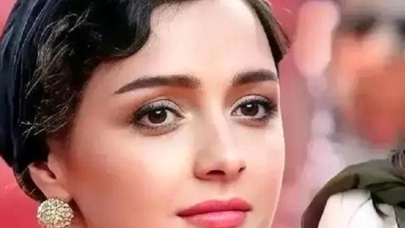 ترانه علیدوستی و راز بیماری پوستی‌اش که همه را شوکه کرد!