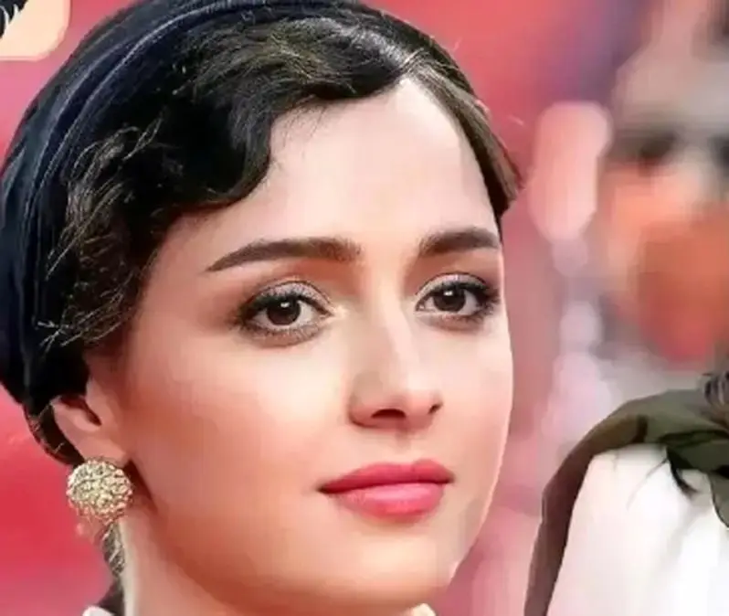 ترانه علیدوستی و راز بیماری پوستی‌اش که همه را شوکه کرد!