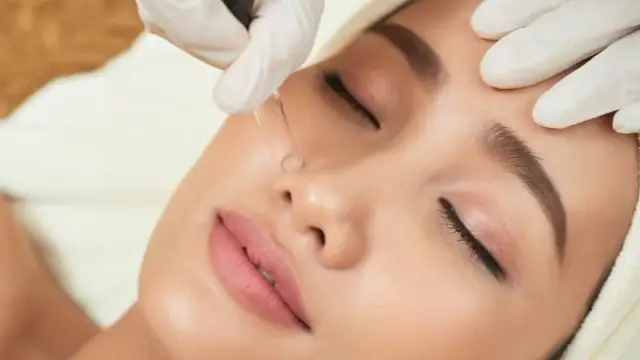 ۱۲ سوال طلایی که قبل از هر عمل زیبایی باید بپرسید تا غافلگیر نشوید!