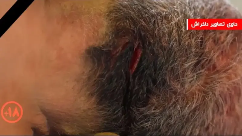 فیلم معاینه دقیق اجساد کشته شدگان ناآرامی های تهران توسط کارشناس پزشکی قانونی / حاوی صحنه های دلخراش