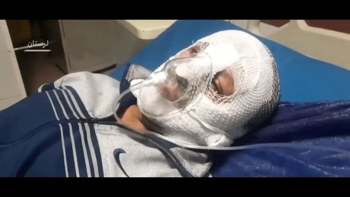 سوختگی صورت یک مامور انتظامی در کوهدشت/ ویدئو