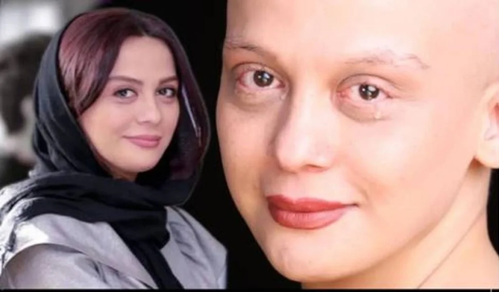 بیوگرافی تلخ مارال فرجاد؛ از بیماری سخت تا سیمرغ بلورین جشنواره فجر - وب‌گردی