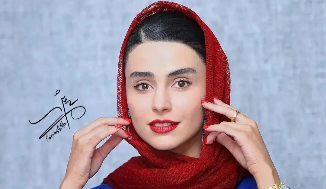 تغییرات باورنکردنی لاله مرزبان؛ وقتی عمل زیبایی هم نتونست نچرال بودنشو بگیره - وب‌گردی