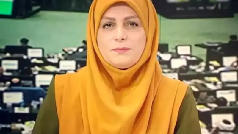 تغییر جنجالی چهره  مجری سابق شبکه خبر