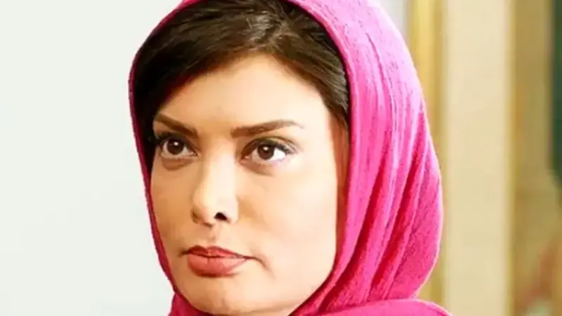 چهره نگار فروزنده بعد از عمل های زیبایی + عکس های شوکه کننده