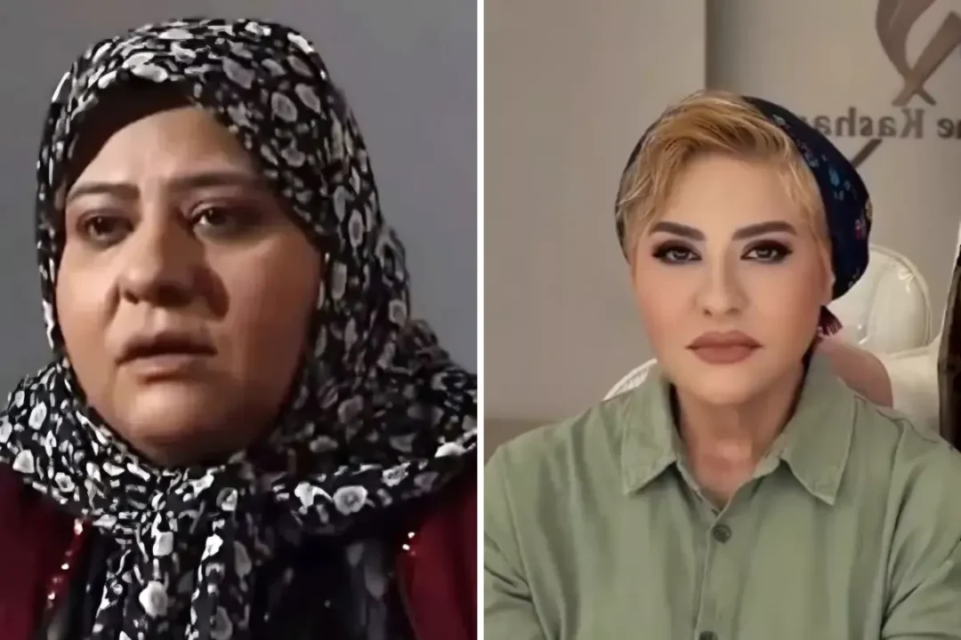 نقد و بررسی تغییر چهره رابعه اسکویی در ۶۰ سالگی - وب‌گردی